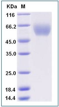SDS-PAGE - Recombinant Mouse Allergin 1 protein (Fc Chimera) (AB277018)