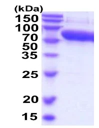 SDS-PAGE - Recombinant Mouse Alpha 2 Antiplasmin protein (His tag C-Terminus) (AB206791)