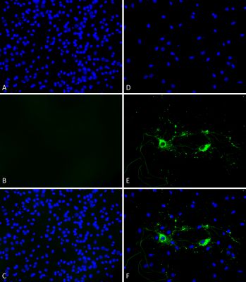 Immunocytochemistry - Recombinant mouse Alpha-synuclein protein aggregate Type 1 (Active) (AB246002), expandable thumbnail