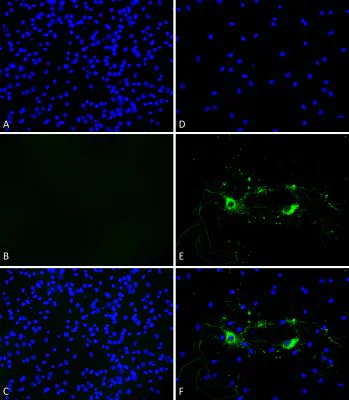 Immunocytochemistry - Recombinant mouse Alpha-synuclein protein aggregate Type 1 (Active) (AB246002)