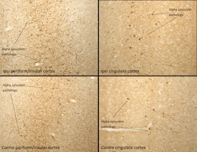 Immunohistochemistry (PFA fixed) - Recombinant mouse Alpha-synuclein protein aggregate Type 1 (Active) (AB246002), expandable thumbnail
