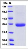 SDS-PAGE - Recombinant mouse Angiopoietin 2/ANG2 protein (His tag) (AB276807)