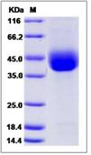 SDS-PAGE - Recombinant Mouse Angiopoietin-like 4/ANGPTL4 protein (His tag) (AB276823), expandable thumbnail