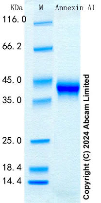 SDS-PAGE - Recombinant Mouse Annexin A1 Protein Standard (His tag) (AB316677)