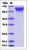 SDS-PAGE - Recombinant Mouse APLP1 protein (His tag) (AB277007), expandable thumbnail