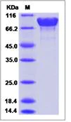 SDS-PAGE - Recombinant Mouse APLP1 protein (His tag) (AB277007)