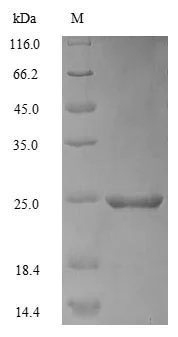 SDS-PAGE - Recombinant Mouse Apolipoprotein CIII (Tagged) (AB226264)