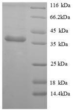 Recombinant Mouse Apolipoprotein E (His tag)