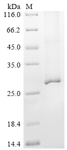 SDS-PAGE - Recombinant Mouse Aqp2 Protein (His Tag) (AB314609), expandable thumbnail