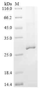 SDS-PAGE - Recombinant Mouse Aqp2 Protein (His Tag) (AB314609)
