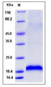 SDS-PAGE - Recombinant Mouse ARMET/ARP protein (His tag) (AB276949)