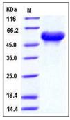 SDS-PAGE - Recombinant Mouse ARSA/ASA protein (His tag) (AB276746), expandable thumbnail