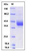 SDS-PAGE - Recombinant Mouse ART4/DOK1 protein (His tag) (AB276975)