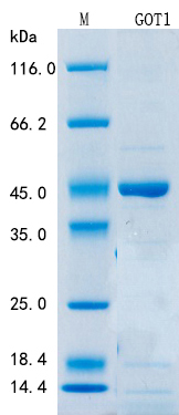 SDS-PAGE - Recombinant Mouse AST Protein Standard (His tag) (AB316374), expandable thumbnail