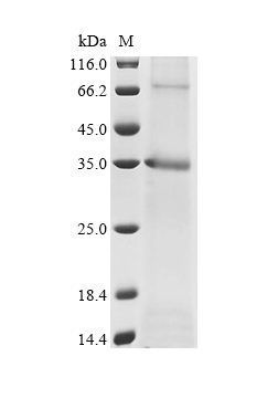 SDS-PAGE - Recombinant Mouse Atp1b1 Protein (His Tag) (AB314612)