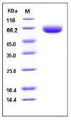 SDS-PAGE - Recombinant Mouse BACE1 protein (His tag) (AB276742)