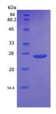 SDS-PAGE - Recombinant Mouse Bax protein (His tag) (AB275569)