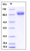 SDS-PAGE - Recombinant Mouse BCAM protein (His tag) (AB276950)