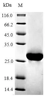 SDS-PAGE - Recombinant Mouse Bcl-2 protein (His tag) (AB235687)