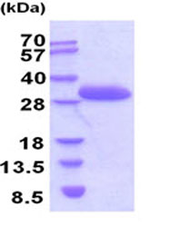 SDS-PAGE - Recombinant Mouse Bcl-XL protein (His tag) (AB206811)