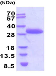 SDS-PAGE - Recombinant Mouse Bcl-XL protein (His tag) (AB206811)