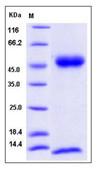 SDS-PAGE - Recombinant Mouse beta 2 Microglobulin + FCGRT/FCRN protein (His tag) (AB277031), expandable thumbnail