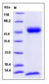 SDS-PAGE - Recombinant Mouse beta 2 Microglobulin + FCGRT/FCRN protein (His tag) (AB277031)