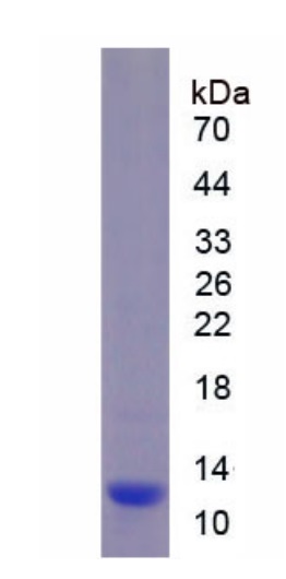 SDS-PAGE - Recombinant Mouse beta Defensin 1 protein (His tag) (AB275558), expandable thumbnail