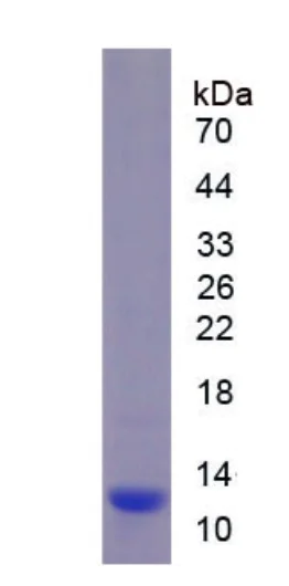 SDS-PAGE - Recombinant Mouse beta Defensin 1 protein (His tag) (AB275558)