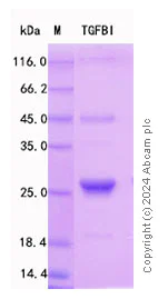 SDS-PAGE - Recombinant Mouse beta IG H3 Protein Standard (His tag) (AB316574)