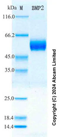SDS-PAGE - Recombinant mouse BMP2 Protein Standard (His tag) (AB316636)