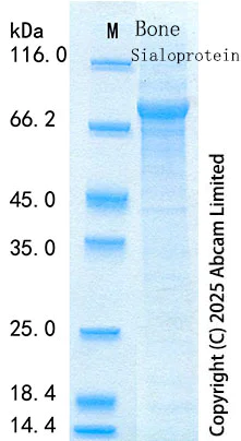 SDS-PAGE - Recombinant Mouse Bone Sialoprotein Protein Standard (His tag) (AB316515)