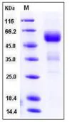 SDS-PAGE - Recombinant Mouse BTC protein (Fc Chimera His Tag) (AB276820)