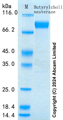 SDS-PAGE - Recombinant Mouse Butyrylcholinesterase Protein Standard (His tag) (AB316698), expandable thumbnail