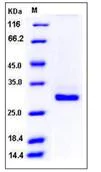 SDS-PAGE - Recombinant Mouse C Reactive Protein (His tag) (AB276840)