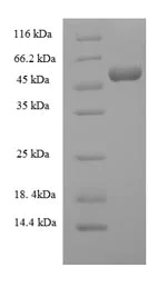 SDS-PAGE - Recombinant Mouse C3 protein (His tag) (AB226433)