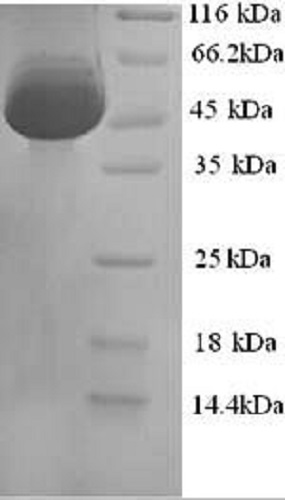 Recombinant Mouse Calreticulin protein (His tag)
