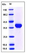 SDS-PAGE - Recombinant Mouse Carbonic anhydrase 10/CA10 protein (His tag) (AB276924)