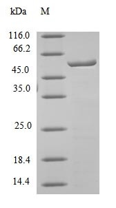SDS-PAGE - Recombinant Mouse Carboxylesterase 1C protein (AB236924)