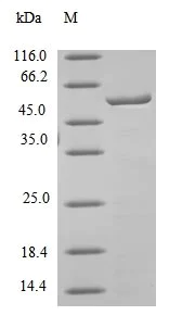 SDS-PAGE - Recombinant Mouse Carboxylesterase 1C protein (AB236924)