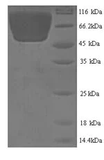 SDS-PAGE - Recombinant Mouse Carboxylesterase 1C protein (His tag) (AB226240)