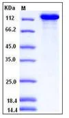 SDS-PAGE - Recombinant Mouse Caspr2/CNTNAP2 protein (His tag) (AB276891)