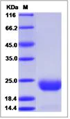 SDS-PAGE - Recombinant Mouse CCDC47 protein (His tag) (AB277012)