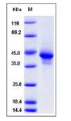 SDS-PAGE - Recombinant Mouse CCL1 protein (Fc Chimera) (AB276787)