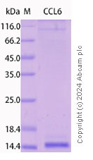 SDS-PAGE - Recombinant Mouse CCL6 Protein Standard (His tag) (AB316494), expandable thumbnail