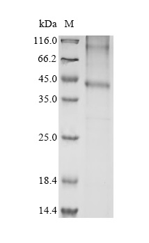 SDS-PAGE - Recombinant Mouse Ccr1 Protein (His Tag) (AB314614)