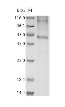 SDS-PAGE - Recombinant Mouse Ccr1 Protein (His Tag) (AB314614)