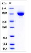 SDS-PAGE - Recombinant mouse CD105 protein (His tag) (AB276838), expandable thumbnail