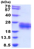 SDS-PAGE - Recombinant Mouse CD137 protein (His tag C-Terminus) (AB208312)