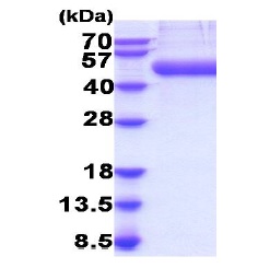 SDS-PAGE - Recombinant Mouse CD14 protein (AB207103), expandable thumbnail